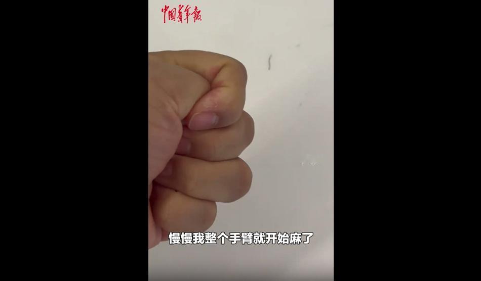 7月11日凌晨三点，北京的冯大姐因为孩子发烧起身照看，忽然感觉左手发麻。一开始