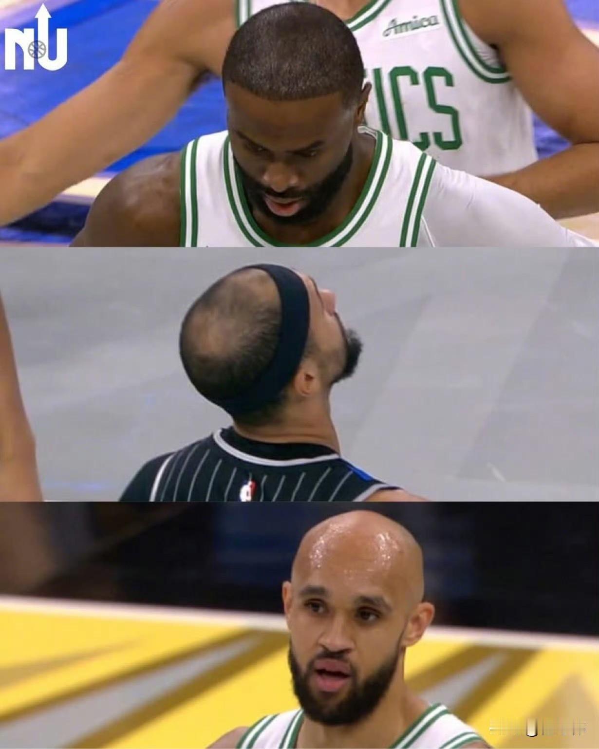 NBA球员秃头的问题确实是非常严重，像老詹，杜兰特都是早早就秃了！而杰伦布朗