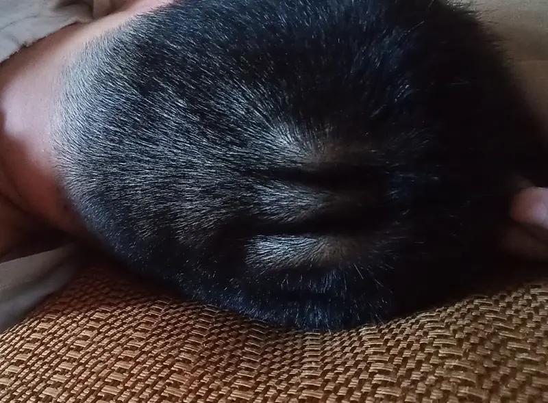 后脑勺晕可太难受了，我之前就经常有这情况。可能是颈椎病导致的，现在很多人长时间低