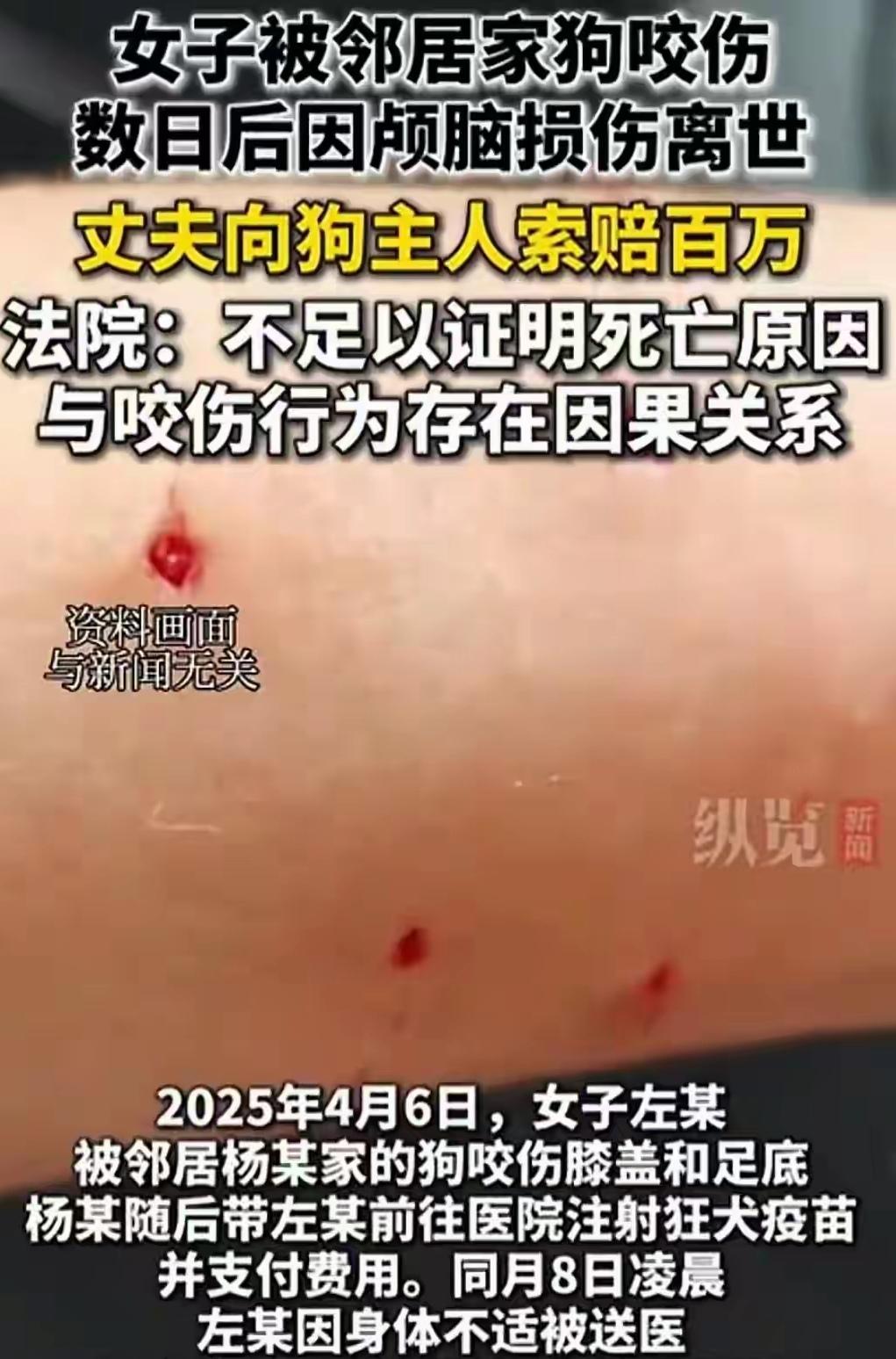 云南，女子从邻居家房后路过，邻居家的狗窜出来抓咬了她的膝盖和足底，邻居带她去做了