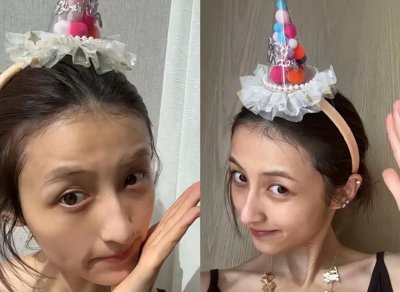 现在的张子枫，给所有爱美的女生提了个醒，你可以去拉皮，也可以去除皱，还可以打苹果