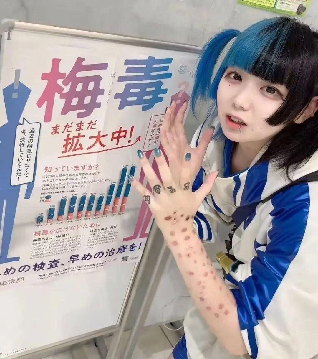 在抗生素诞生之前，梅毒是一种令人闻风丧胆的“世纪瘟疫”。这种由梅毒螺旋体引发的传