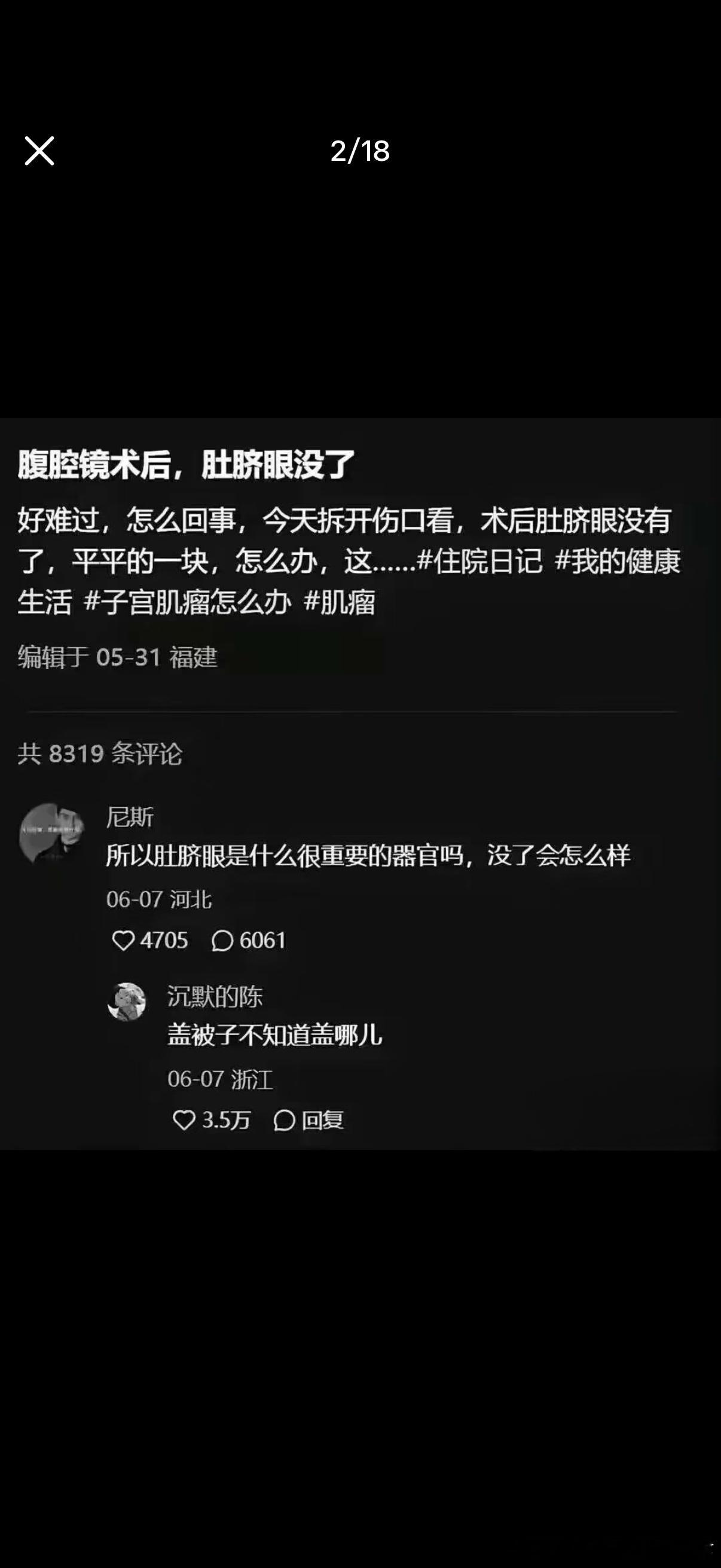 5978中国人睡觉一生的追求之盖肚脐眼