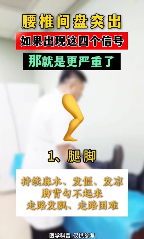 腰突出现这4个信号，说明压迫已经很严重