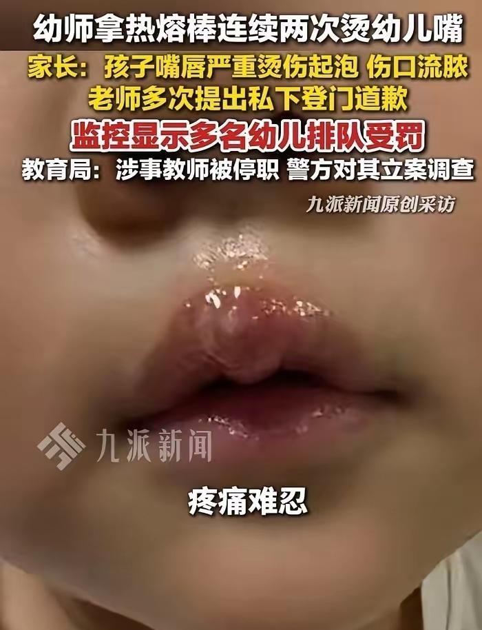 五月初江苏徐州发生的一起恶行再次刺痛公众神经——幼儿园监控清晰拍下：一名教师手持