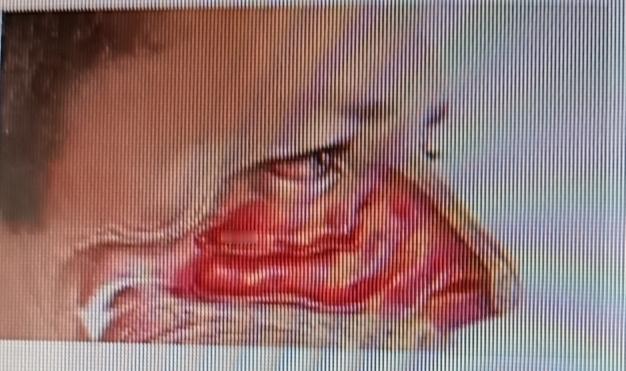 息肉这玩意儿现在越来越常见，体检时很多人在胃肠、胆囊啥的地方都查出有息肉。中国医