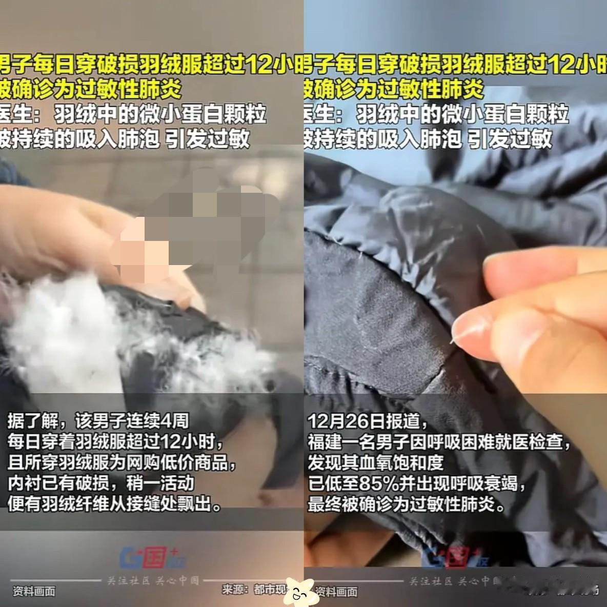 福建福州，一男子低价网购了件羽绒服，每天穿着超过12小时，破了也不舍得扔，一个月
