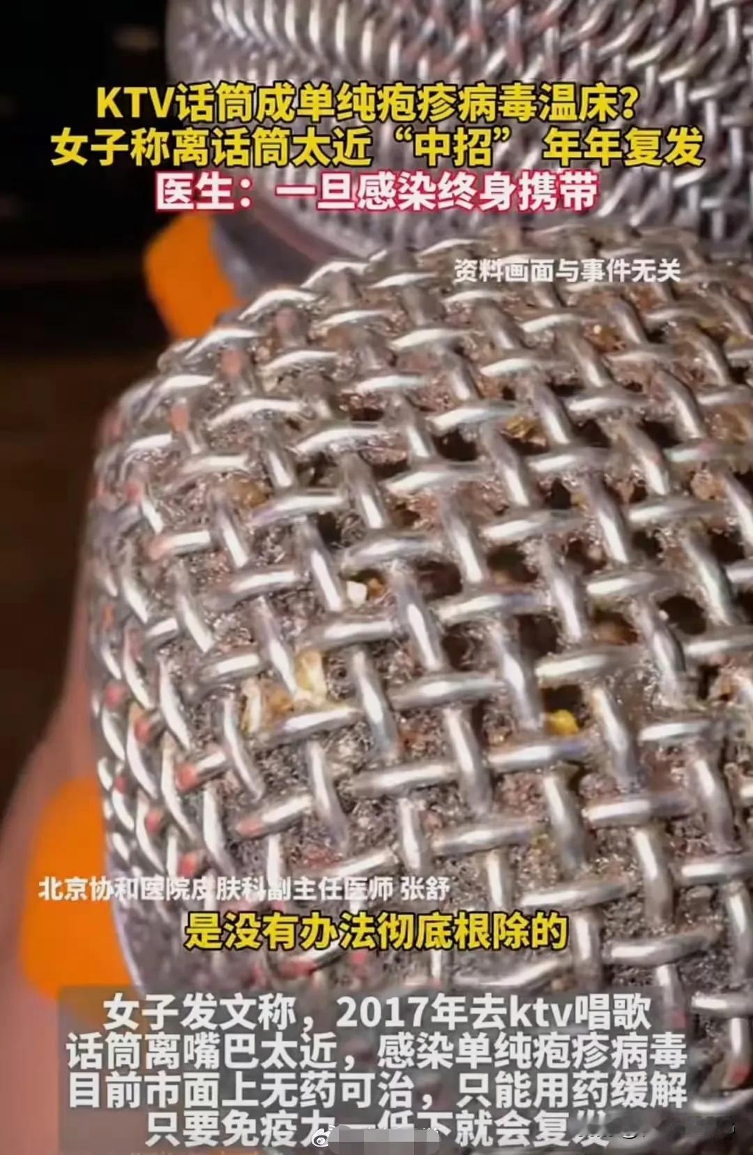 某KTV夜场的麦克风，真恶心🤮，你还经常去K歌吗[无奈吐舌]