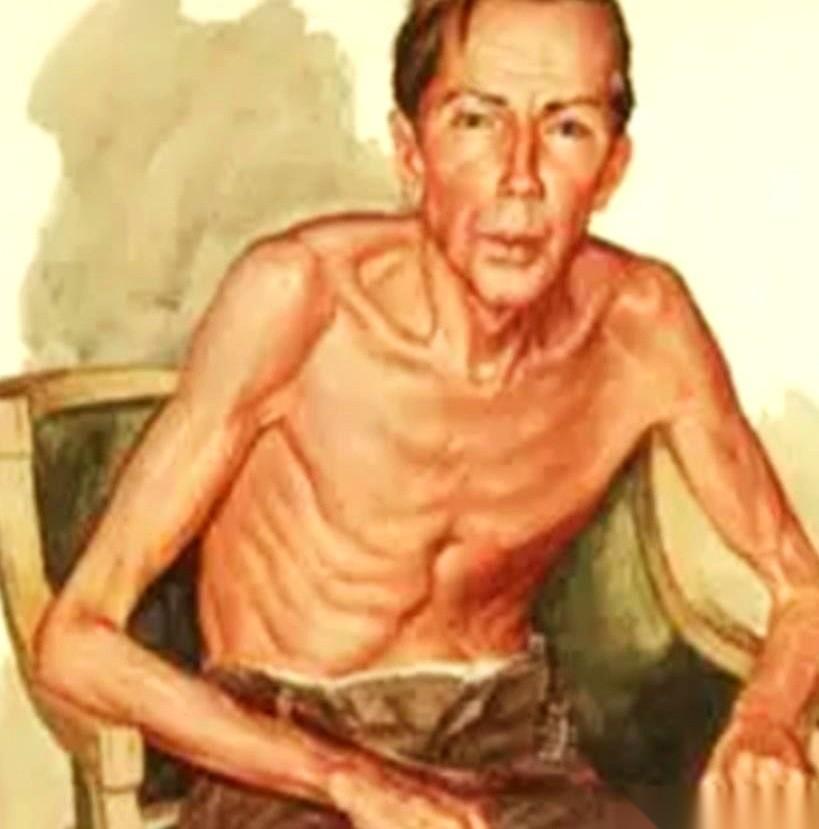 这世界上最诡异的死法，可能就是活活“吃死”的吧。肚子是饱的，人却在枯萎。眼睁