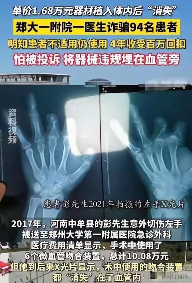 医生王福建有多可恨吧！给断四根指头农民工做台手术，收费14万，转身就把10多万的
