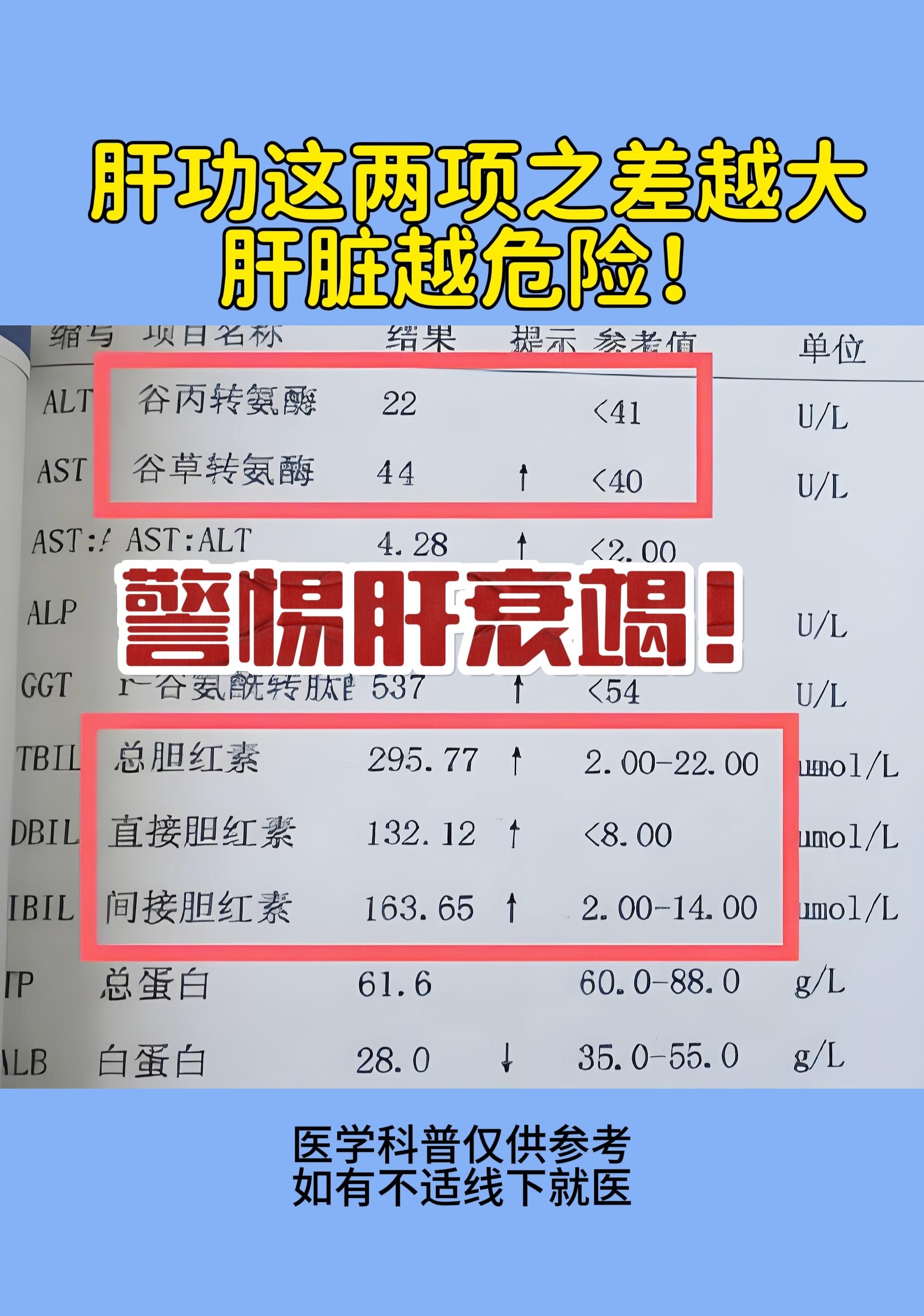 这张报告单是一位处在肝硬化失代偿的山东患者的，来的时候就能看到脸色明显...