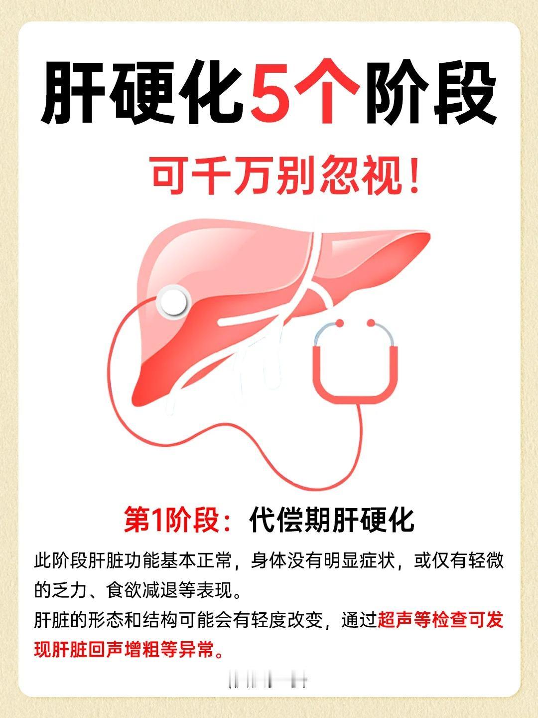 肝硬化的5个阶段，可千万别忽视！
