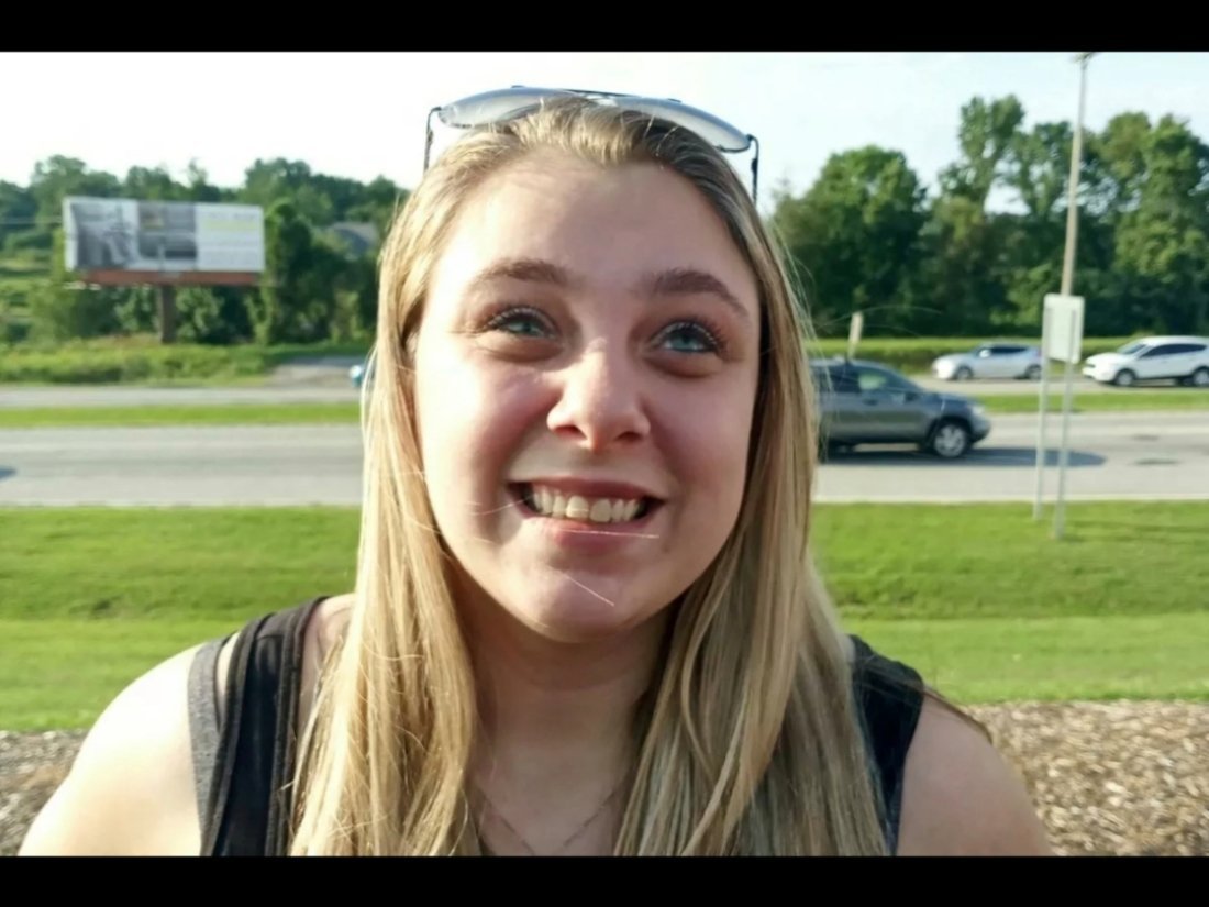 美国这个女生吸食冰毒，把自己两只眼抠了出来。七八个人把她按住，送到医院手术。¹