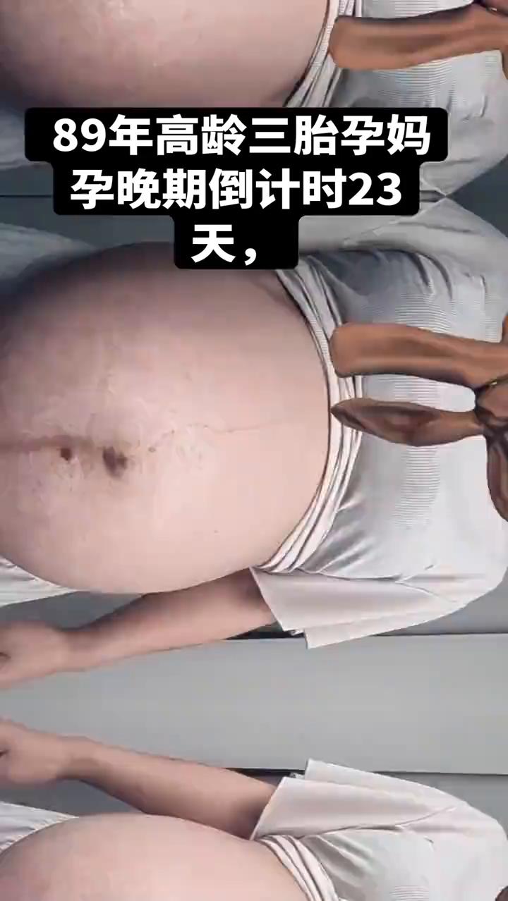 89年高龄三胎孕妈孕晚期倒计时23天。