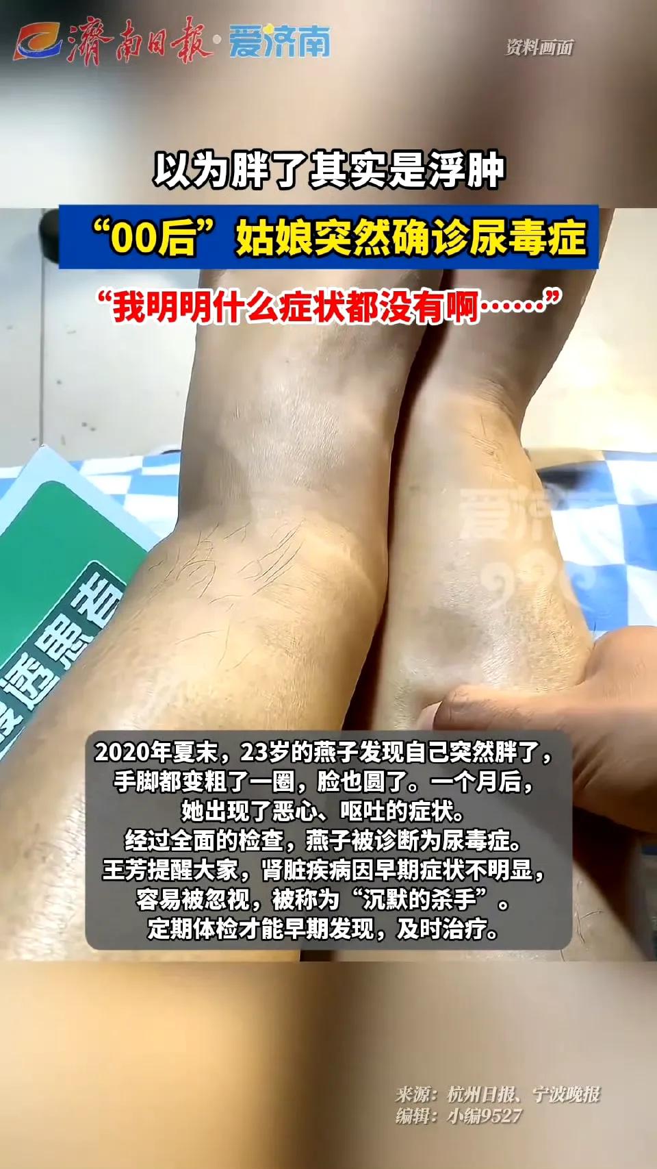 别让“沉默的杀手”悄悄靠近！女子暴增58斤竟非肥胖，而是尿毒症警报！安徽一名