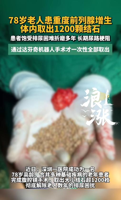 广东深圳，一78岁男子身患多种基础病，还有重度前列腺增生，多年排尿困难，在医院接