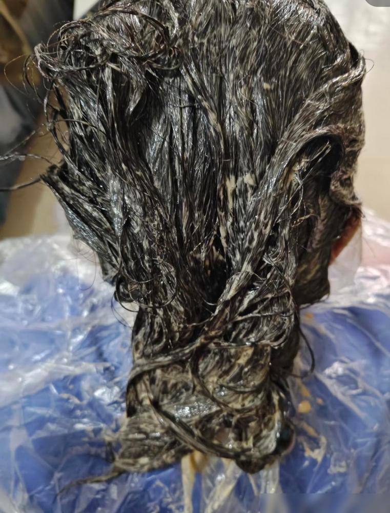 真心奉劝大家，能不染发就别染了。我表嫂，今年61，前几天忽然觉得浑身无力，上卫生