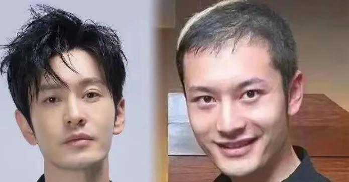 看了黄晓明的图片我默默做了一个决定不是要戴假发，也不是要去医美，而是要去植发