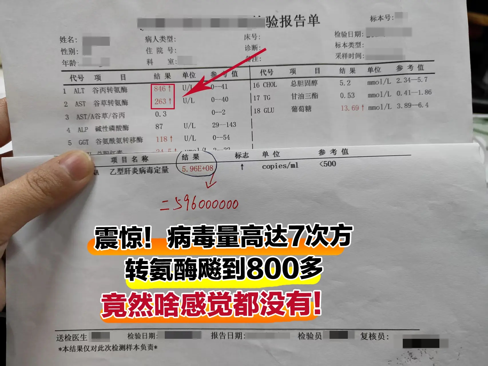 震惊！这位山东济宁的患者，乙肝病毒量高达7次方，转氨酶飚到800多，竟...