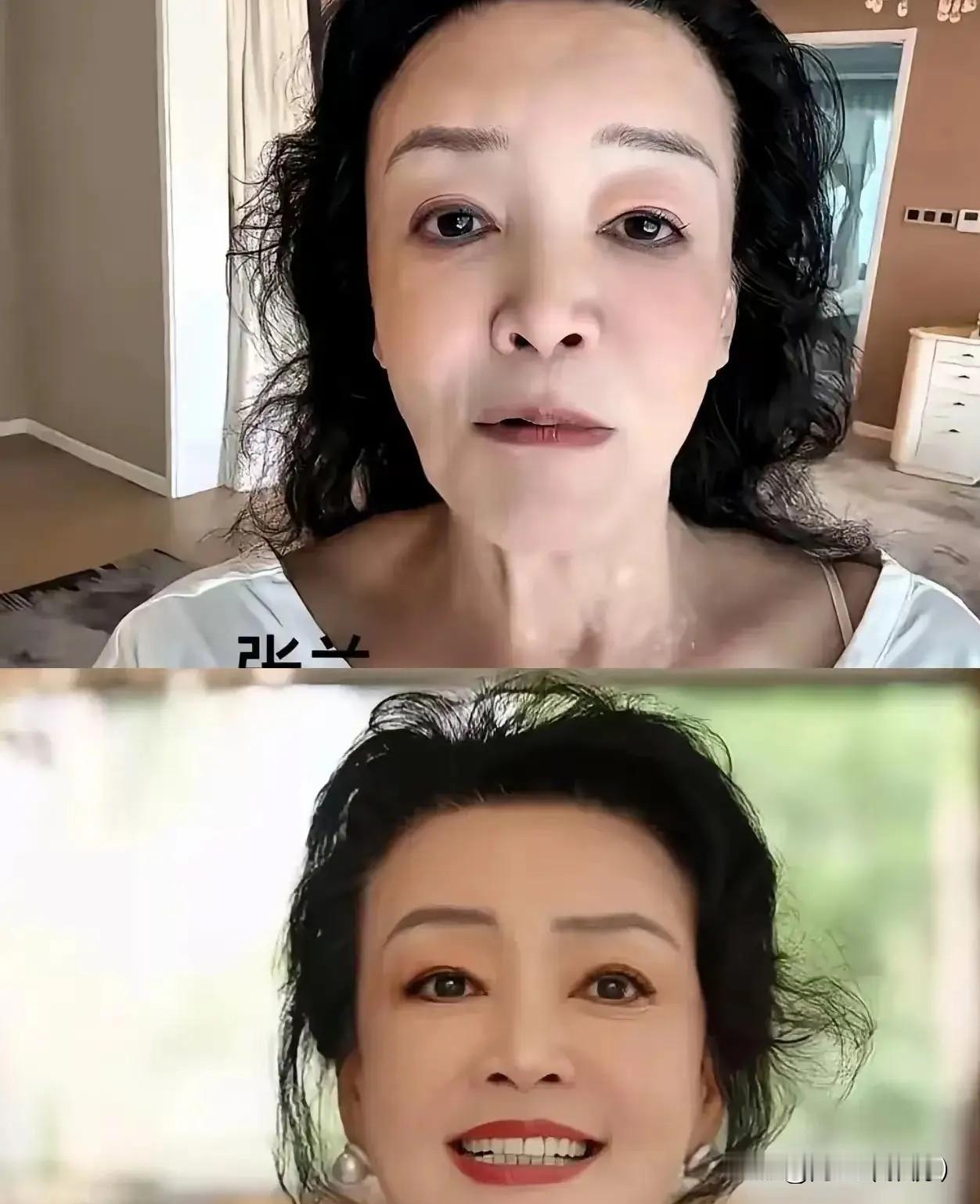 近期张兰身形暴瘦引发全网热议，对比去年饱满精神的状态，如今的她憔悴沧桑，落差格外