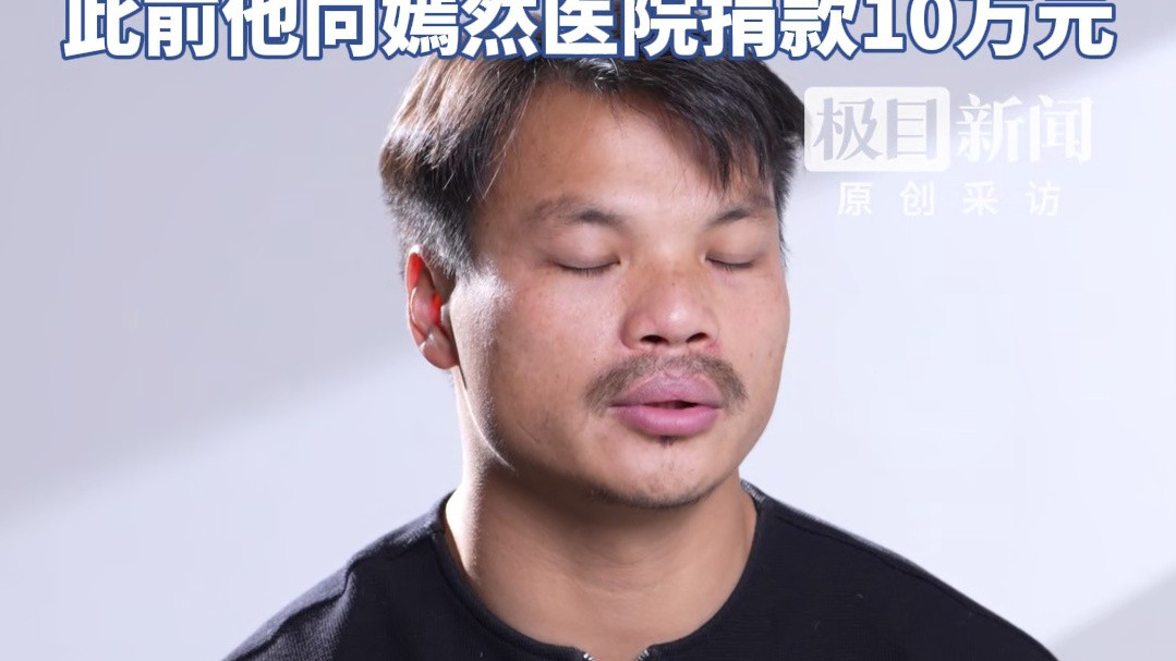 网络博主嘴哥：10万元捐款背后4次手术与毛囊移植的励志故事