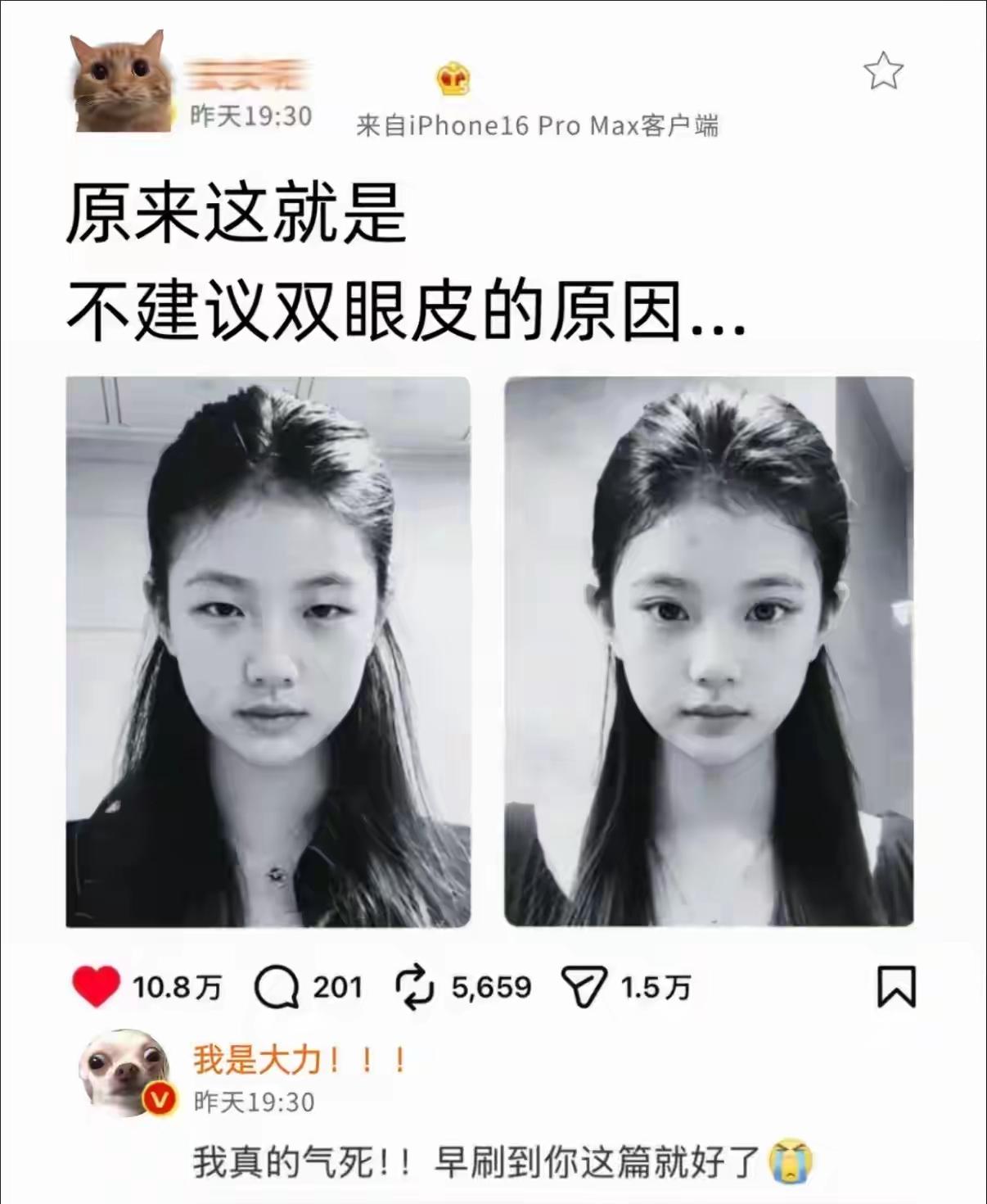 割了双眼皮，像路人，不割之前，绝对是女神，大家说是不是？双眼皮割毁双眼皮变形