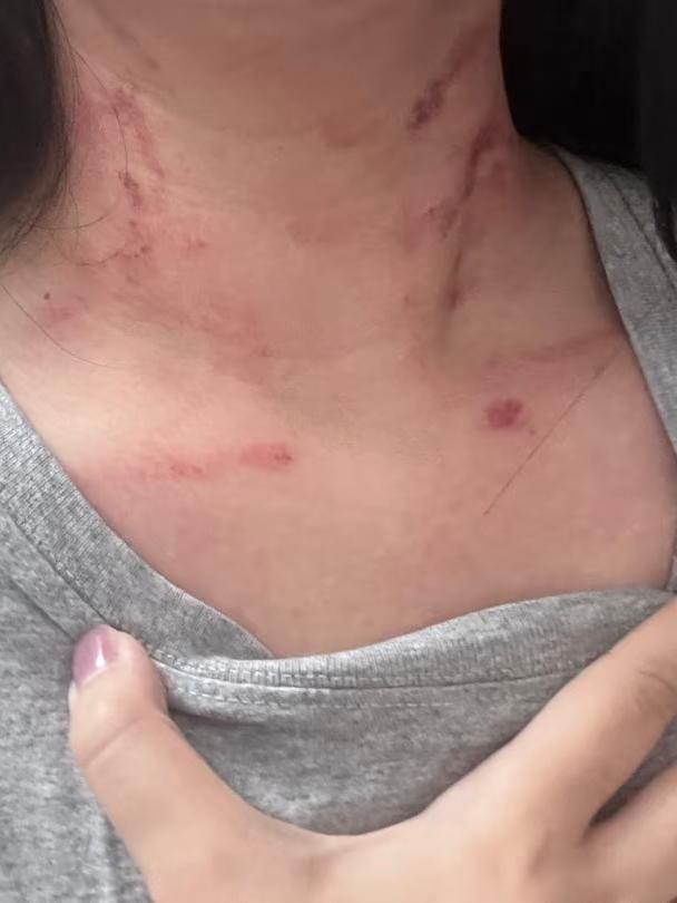 被亲哥打了我同事最近真的太委屈了，她现在住的这套房子，当初首付爸妈钱不够