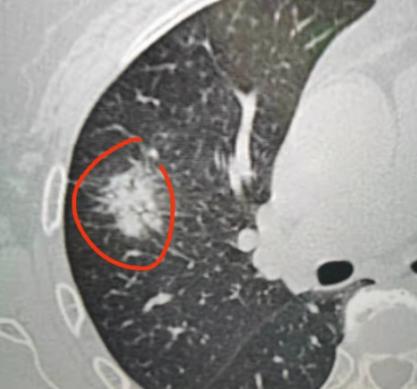 今年76岁的老爷子，退休后本就该安安稳稳享清福，每天遛遛弯、日子过得舒心自在。可