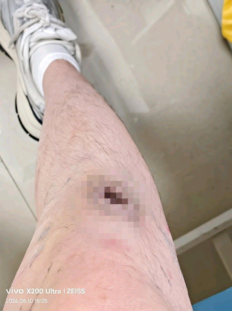 这事儿真让人无语。21岁开板材店的男子，就因为熬夜被父母送进重庆永川区的素质拓展