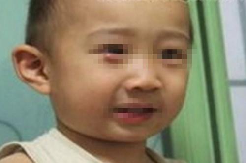 宝宝眼皮长小黄点, 奶奶用针扎破, 孩子哭闹送医, 医生: 您真狠