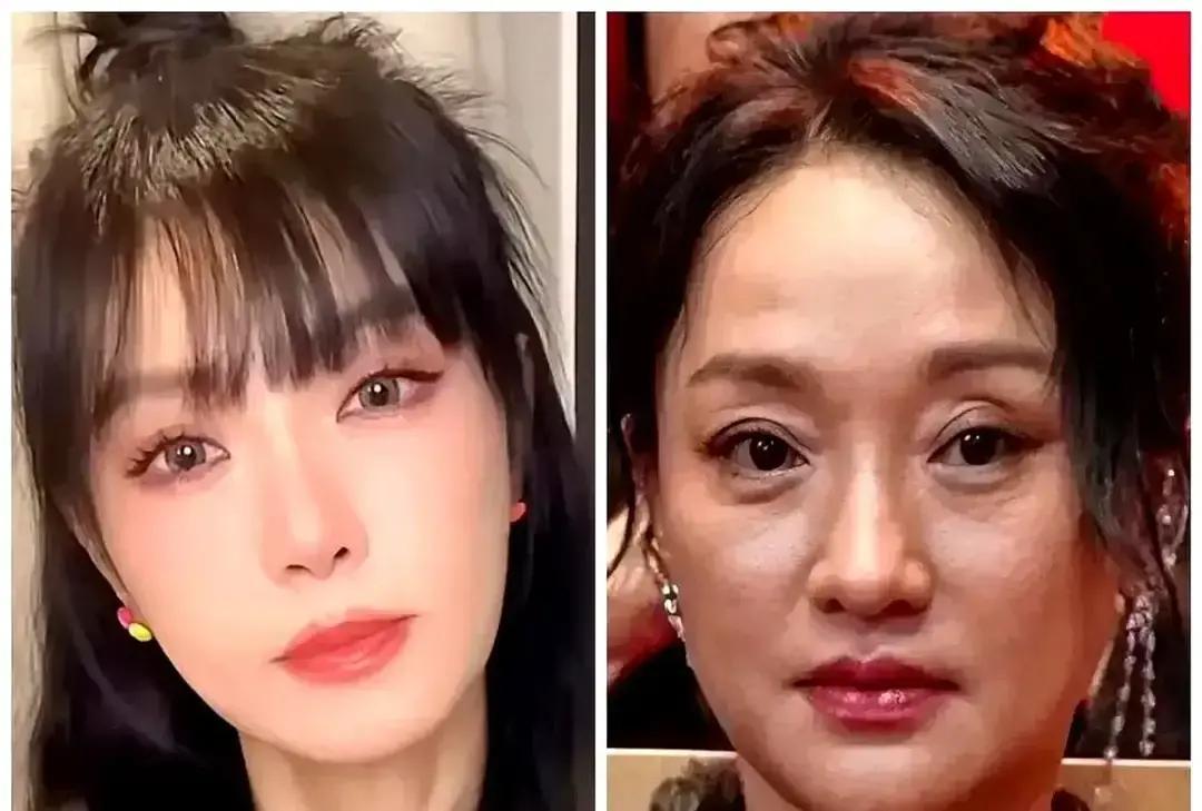 被生活拖垮的脸，医美救不了。你看林志玲和杨谨华，同岁。一个产后复出，体态像