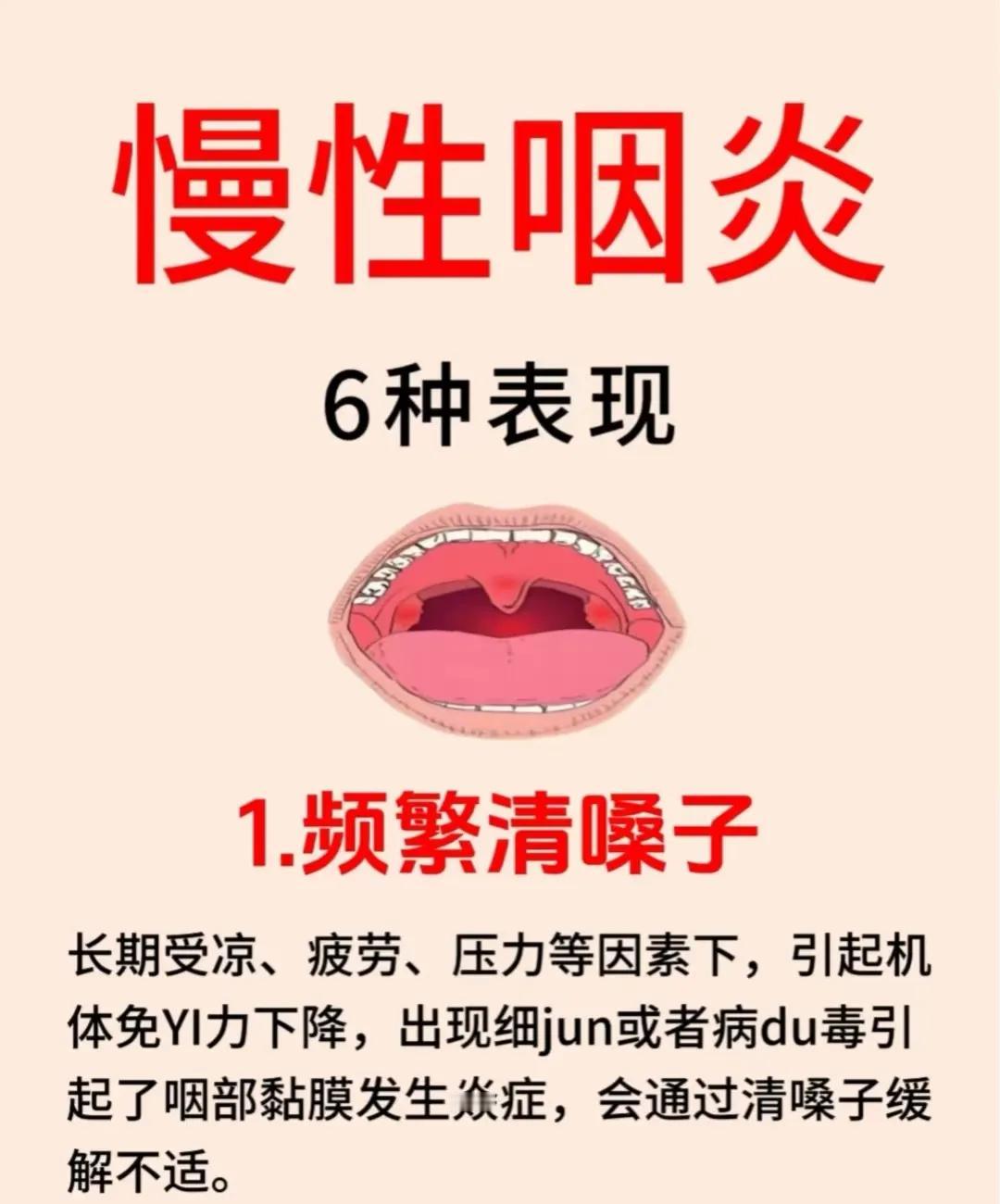 慢性咽炎必须要忌口吗?慢性炎症必须忌口是前提，还得转移注意力避免焦虑，最近辩