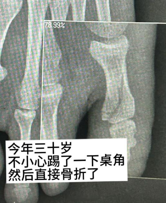 人到了三十岁就变得很脆皮​​​