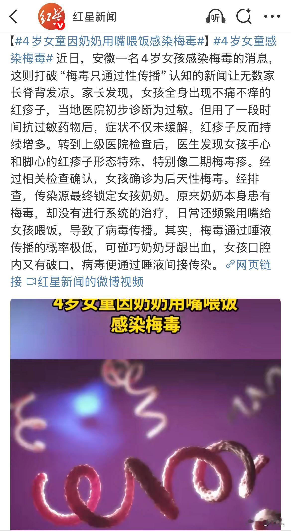 4岁女孩，因为奶奶嚼饭喂她，染上了梅毒。全身起红疹，一开始还当着过敏治。这大