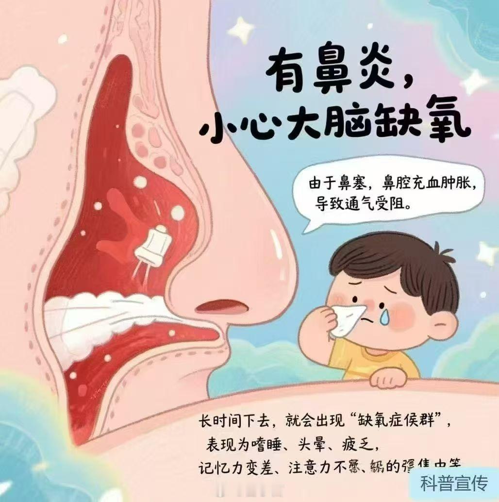鼻炎记忆力下降鼻炎真的会影响记忆力！从生理机制来看，鼻炎引发的长期鼻塞会导