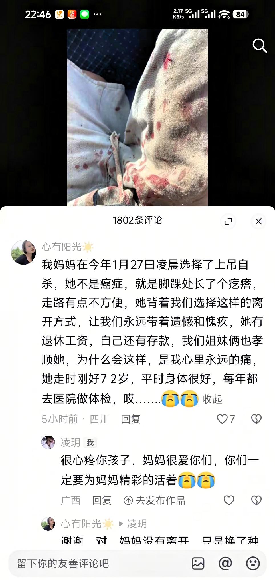 我妈妈在今年1月27曰凌晨选择了上吊自杀，她不是癌症，就是脚踝处长了个疙