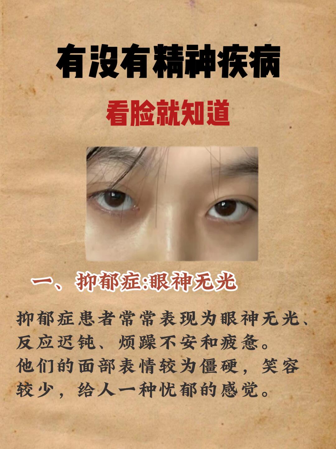 一个人有没有神经疾病，看脸就知道﻿抑郁症焦虑症 ﻿  ﻿中医 ﻿  ﻿...