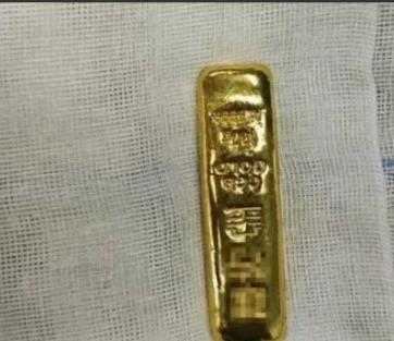 真实版的“吞金兽”现身江苏！一个11岁男童因贪玩，竟将一根100克的金条整个吞下