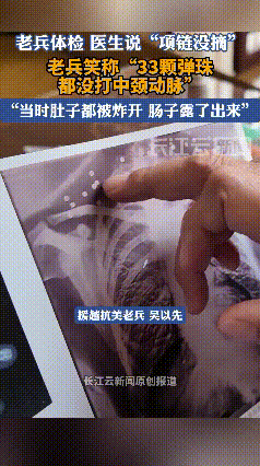 “这就是命啊！”4月12日，湖北武汉，一老人到医院里检查身体，拍CT的时候医生看