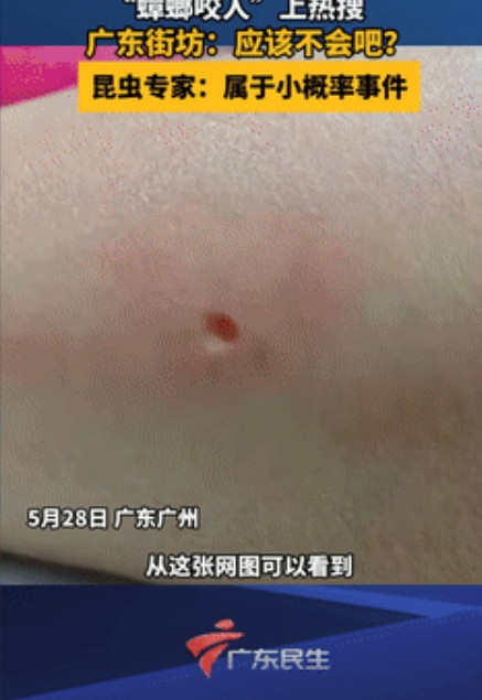 不可大意了！广东，有人分享被“小强”咬的可怕经历，腿上像少了一块肉一样，不少人感