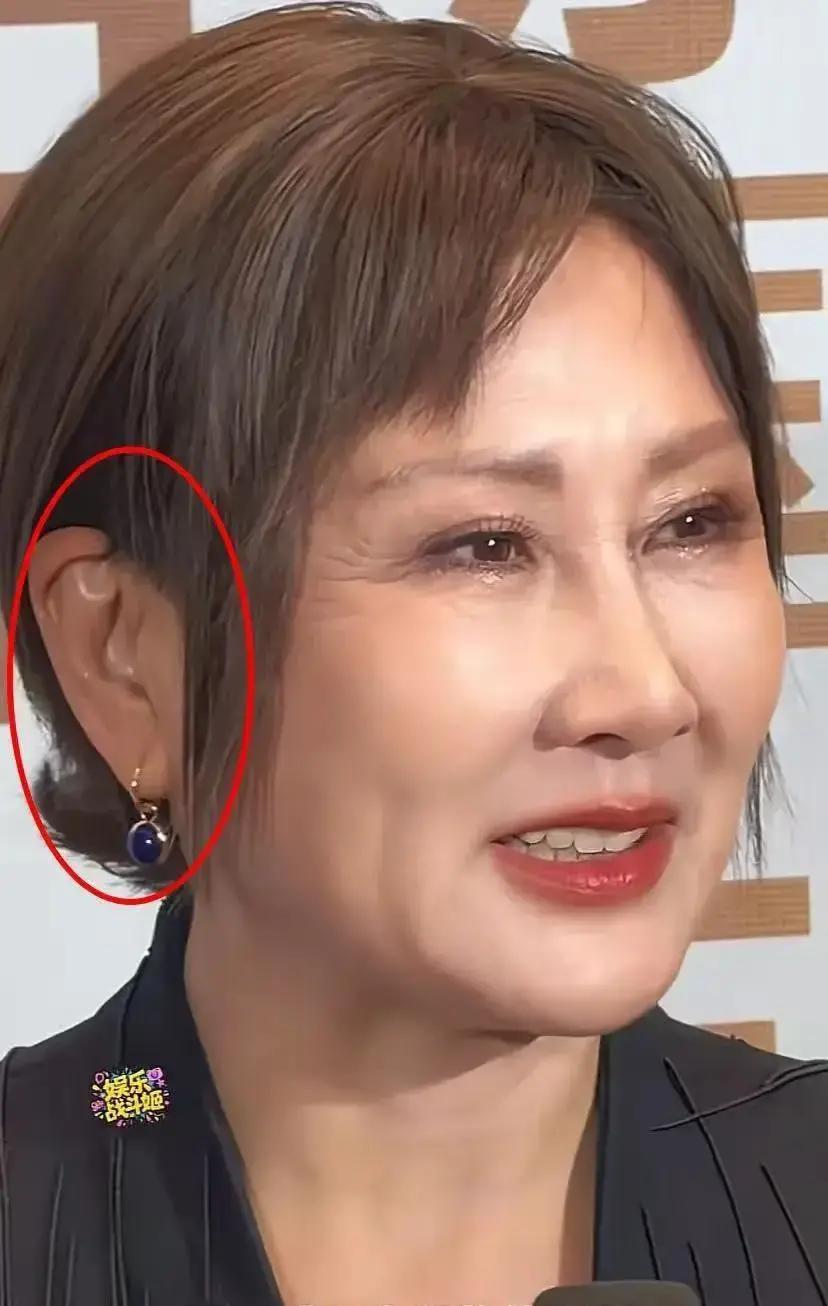 她的耳朵是不是真的动了刀？别再盯着耳廓形状猜了。北京协和整形外科主任在央视