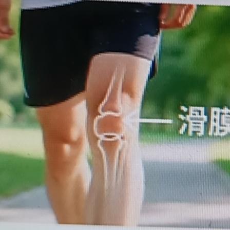 中老年朋友有滑膜炎可太遭罪了。我来分享点实用小妙招。先说表现，患滑膜炎后，膝关