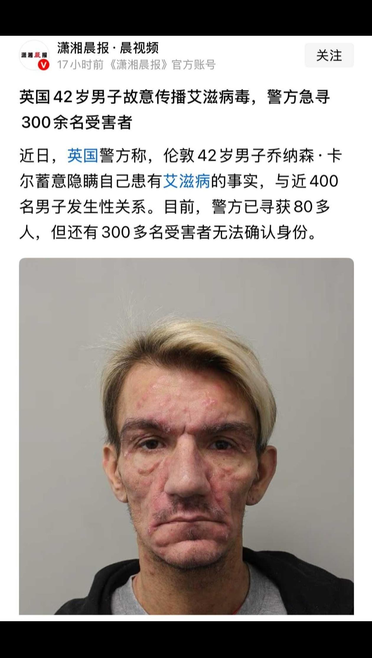 脸都麻成这样了，还有人凑上去？