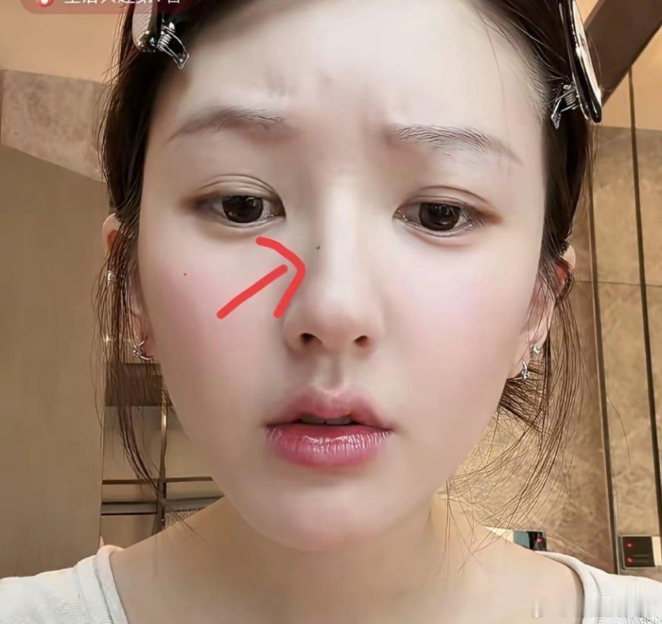发现了没有赵露思有一个点很特别仔细看看直播的照片，她鼻子上的那颗痣真的太显眼