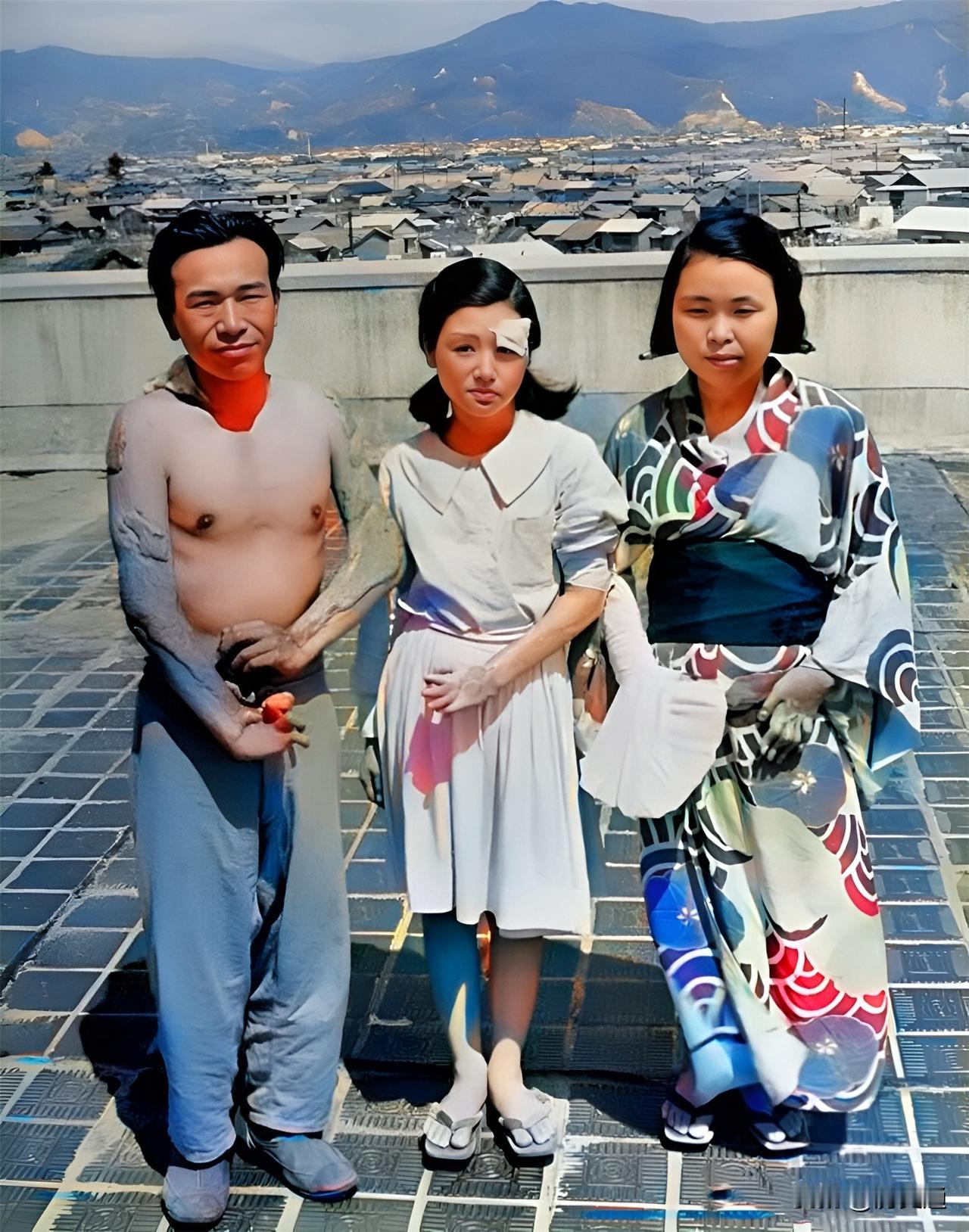 这三名畸形日本人并非先天畸形而是被原子弹爆炸后的强烈波光所烧成畸形的。日本广岛（