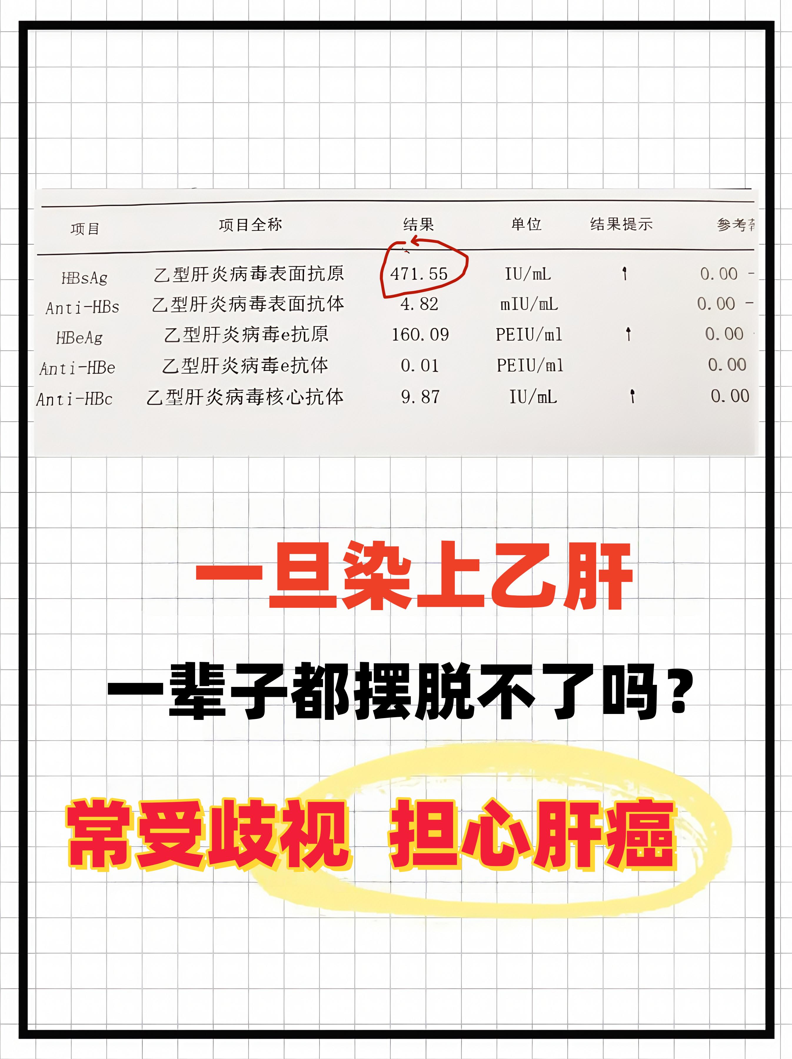 这是一位山东莱芜的乙肝大三阳患者的乙肝五项检查报告，这位患者从查出乙肝...