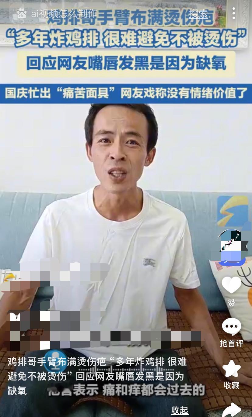 【鸡排哥手臂烫成“地图”？网友：这是劳动者的勋章！】鸡排哥布满烫伤疤痕的手臂火