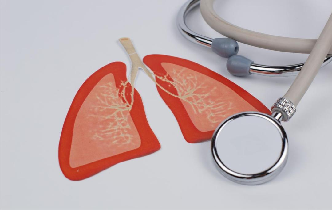 肺部结节有一部分是恶性的，这一小部分恶性结节导致每一个结节患者都很焦虑，肺结节如