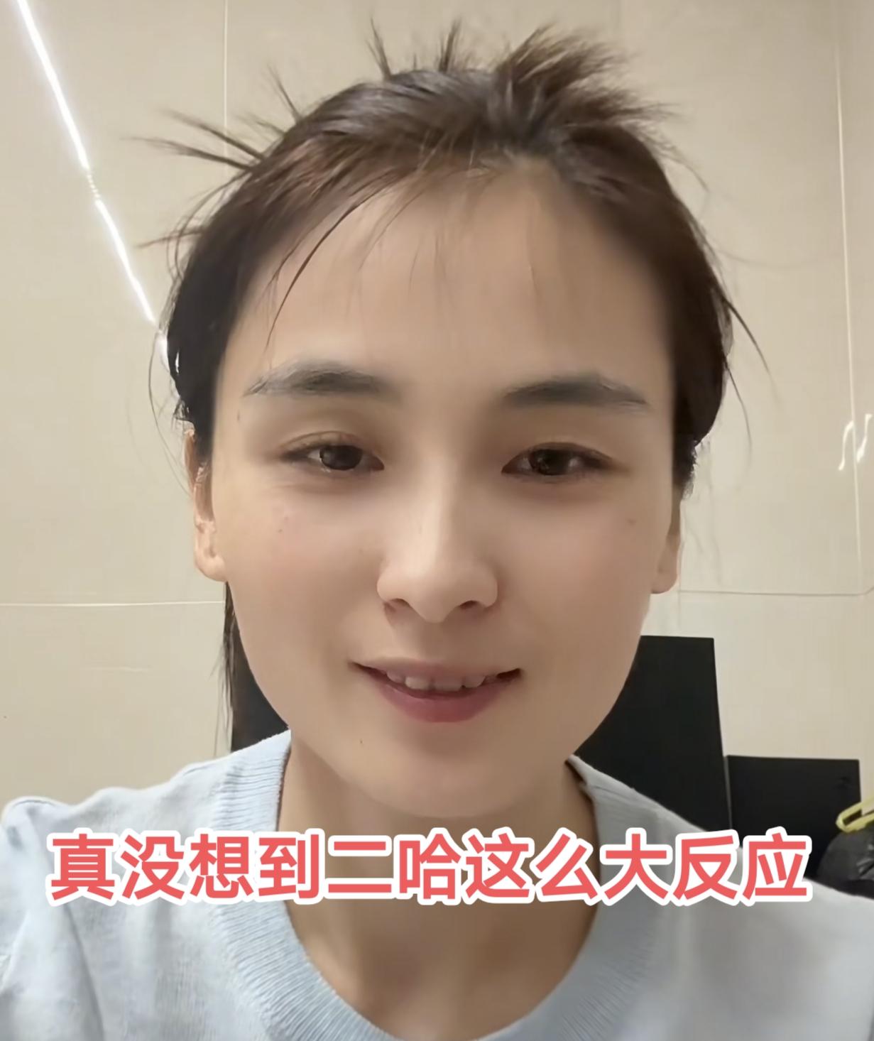 估计瑾汐也没有想到她只是回忆了一下曾经的经历没想到二哈会有这么大反应！不