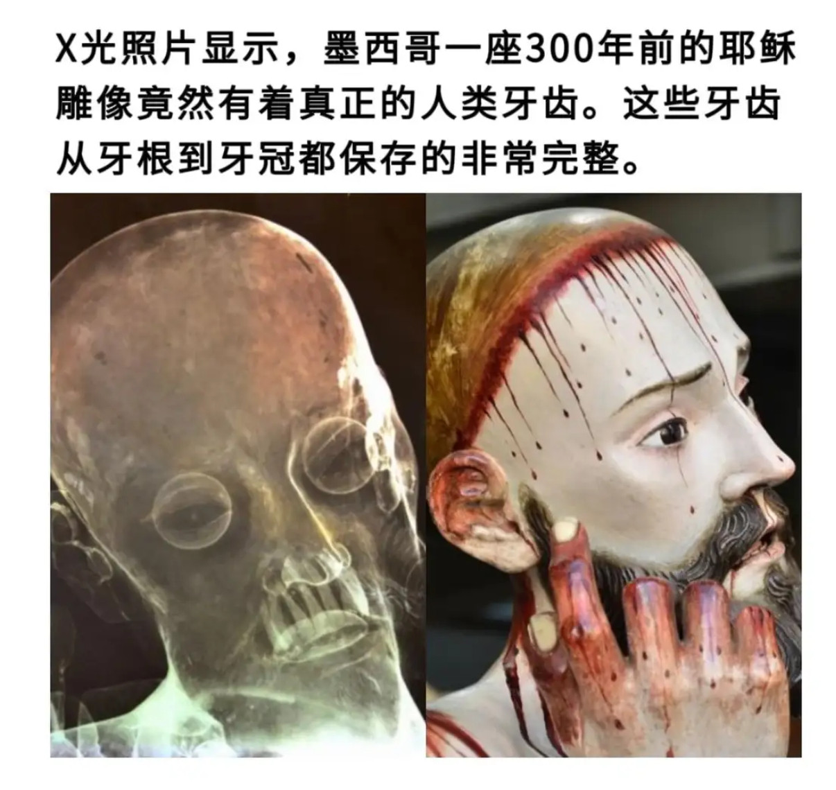 惊！300年前墨西哥耶稣雕像藏人类真牙